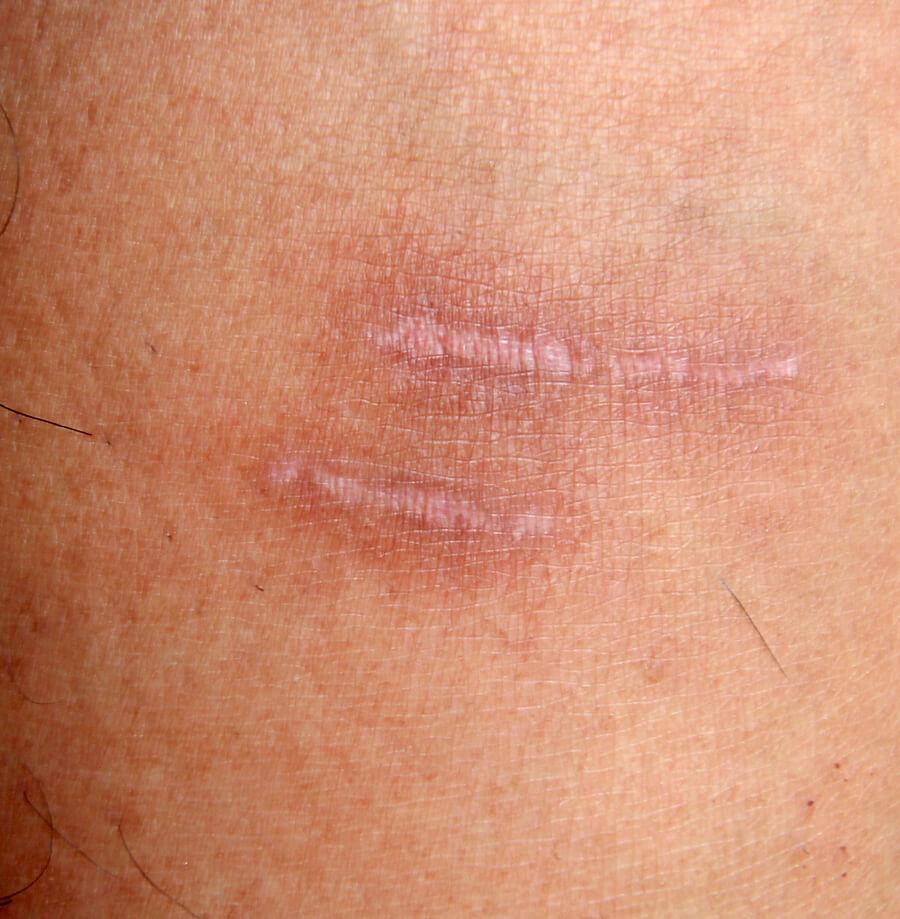 www.dermatografie.nl