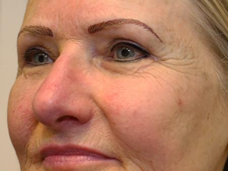 Wenkbrauwen en Eyeliners opnieuw geplaatst bij tattoo bob. Bij tattoo bob is de make up echt permanent, geen eindeloze herhalende behandelingen meer noodzakelijk.
