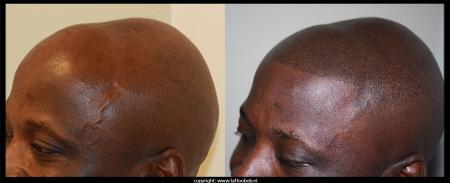 afro-stoppel-5-7-25.jpg