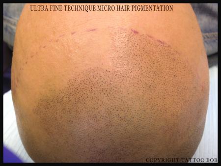 ultra fine technique micro hair pigmentation.jpg