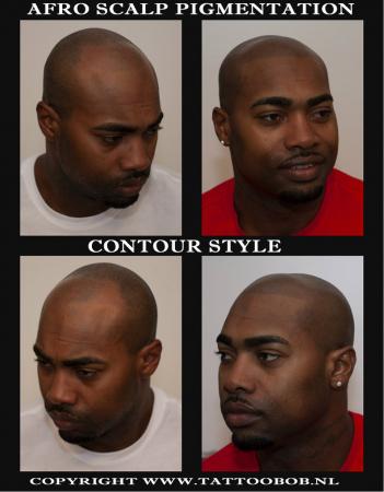 For Dark skin is The afro pigmentation the solution for baldness. Tattoo Bob is the founder of scalp pigmentation for black people. 