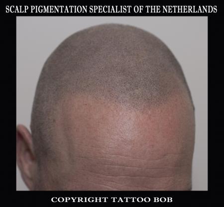 SCALP TATTOO 2018.jpg