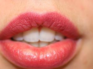 Krijg mooie sprekende lippen na het ondergaan van een full lips behandeling.
