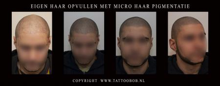 HAAR OPVULLEN MET MHP.jpg