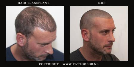 stoppel tattoo mhp 25-10.jpg