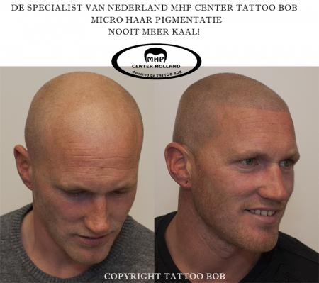 Zie er weer jong en fris uit met micro haar pigmentatie.