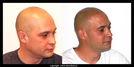 haarpigmentatie-4-6.jpg