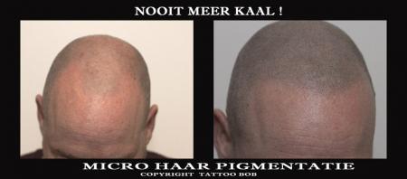 micro haar pigmentatie close up.jpg