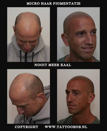 de sensatie van het jaar micro haar pigmentatie