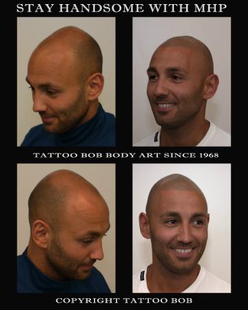 Micro haar pigmentatie is een methode om af te rekenen met kaalheid. Tattoo Bob is in Nederland de pionier op het gebied van Body art. Het woord stoppeltattoo is dan ook bedacht door Tattoo Bob.