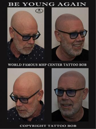 De stoppeldokter van Tattoo Bob is de expert op het gebied van Micro haar pigmentatie
