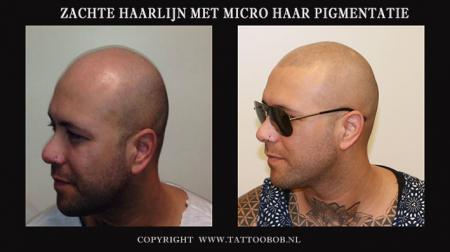 zeer zachte haarlijn met micro haar pigmentatie ook wel bekend als stoppel tattoo