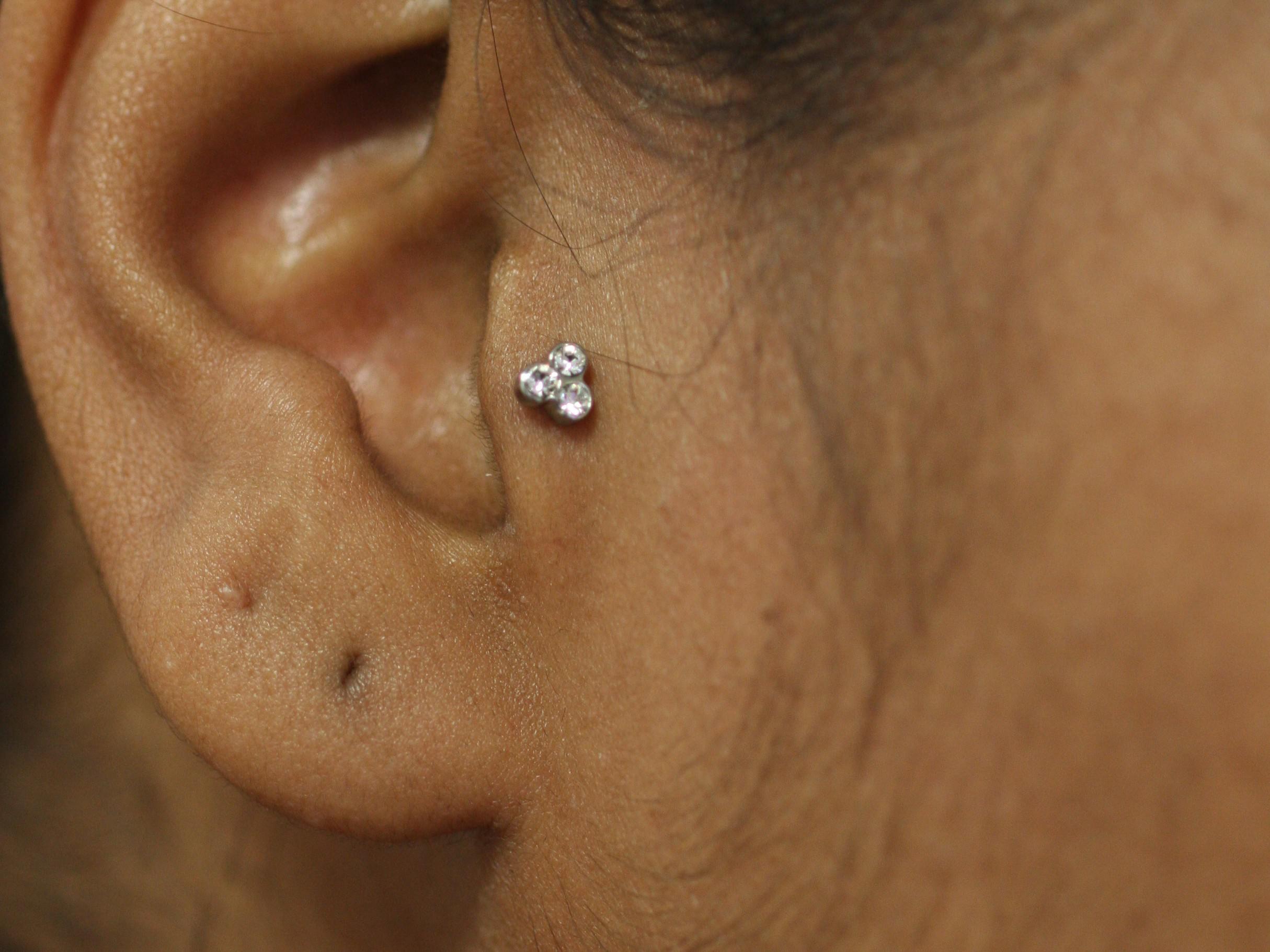 tragus helix