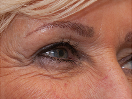 Permanent make up met een mooie zachte bruine tint. Door de 3D techniek komen de permanente wenkbrauwen zeer realistisch over.