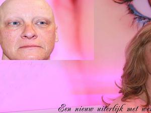 Voor mensen met alopecia kan permanente make up een goede uitkomst zijn. Het dagelijks tekenen van wenkbrauwen kan een moeilijke en tijdrovende klus zijn.