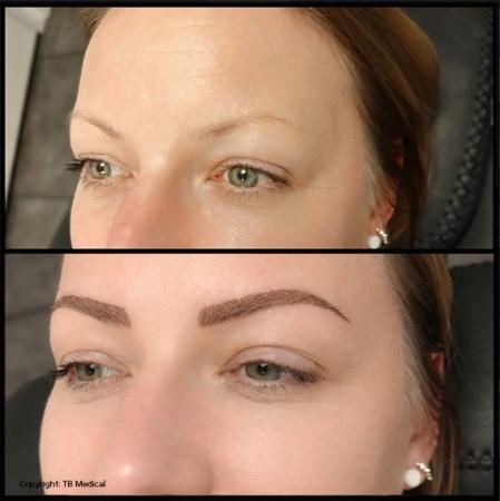 wenkbrauw-voor-en-na-16-4-26-1.jpg