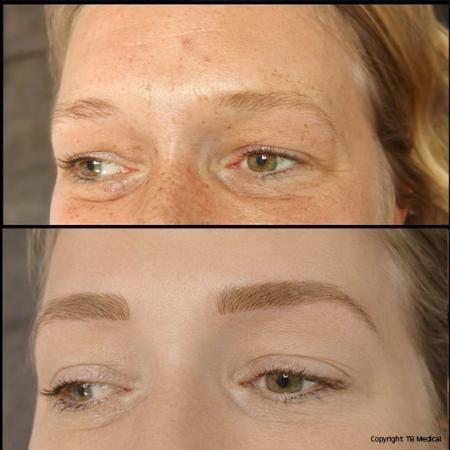 wenkbrauw-voor-en-na-18-4-26-2.jpg