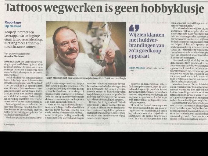 Tattoo verwijderen is geen hobby klusje