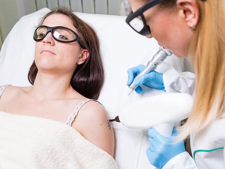 Tattoo verwijderen met een laser